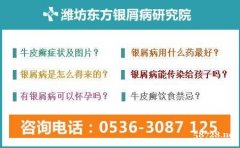 日照银屑病医院在哪个位置